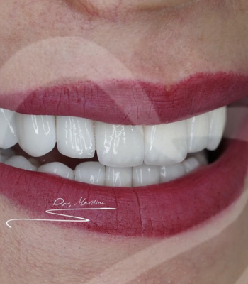 Screen Shot 2022-01-23 at 20.47.24