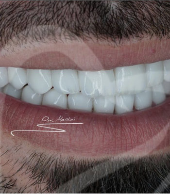 Screen Shot 2022-01-23 at 20.47.50