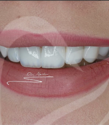 Screen Shot 2022-01-23 at 20.48.08