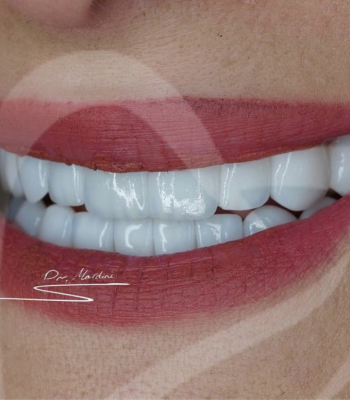 Screen Shot 2022-01-23 at 20.48.21